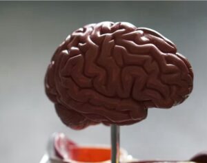 Brain feels too full. Image shows a model brain on a stand